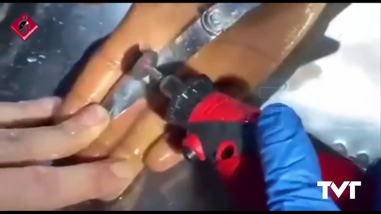 Imagen de Cuando un anillo aprieta tanto que se convierte en un problema