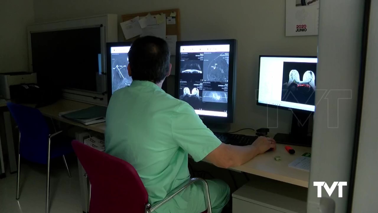 Imagen de  CSIF denuncia la falta de radiólogos en el Departamento de Salud de Torrevieja